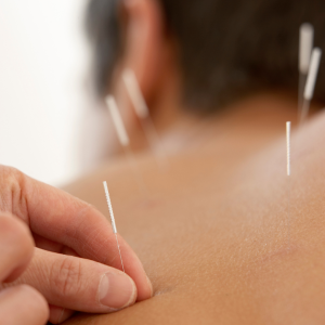 Autoimmune Acupuncture