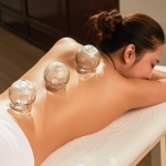 Cupping Acupuncture Pain