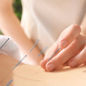 Eating_Disorders_Acupuncture